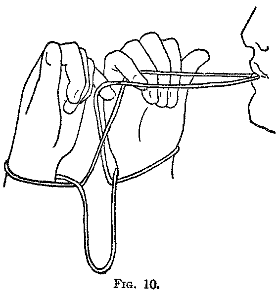 Fig. 10 Fig. 10