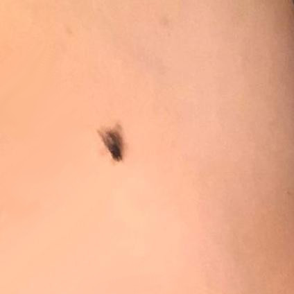 A housefly on Kabutroid's arm